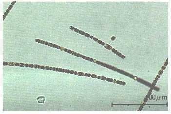 茶色の丸い点状が横一列に並んだ棒状のプランクトンを100マイクロメートルサイズの目盛りで表した顕微鏡の写真