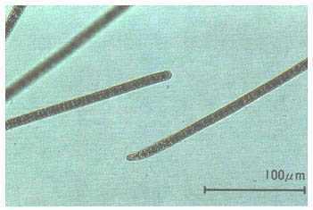細長い茶色の棒状をしたプランクトンを100マイクロメートルサイズの目盛りで表した顕微鏡の写真